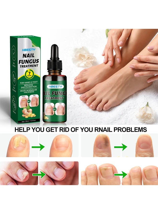 HBESTY 7 Days Nail Fungus Treatment, Moisturize the Cuticle & Strengthen Nails and Helps Nails Healthy Grow Nail Repair Treatment Solution Restoring Healthy Nails 30ml - Image 3