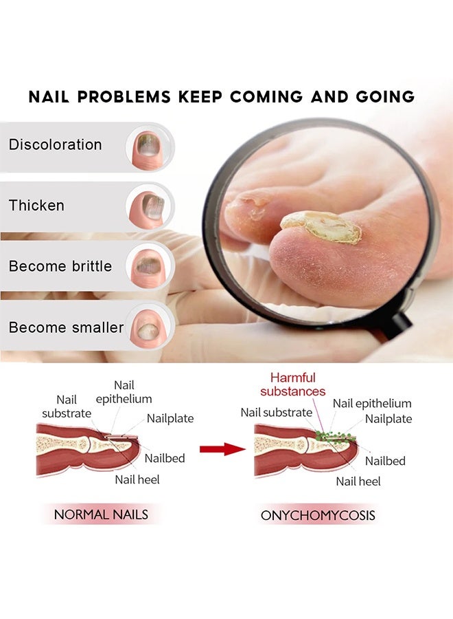 HBESTY 7 Days Nail Fungus Treatment, Moisturize the Cuticle & Strengthen Nails and Helps Nails Healthy Grow Nail Repair Treatment Solution Restoring Healthy Nails 30ml - Image 4