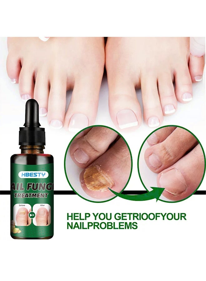 HBESTY 7 Days Nail Fungus Treatment, Moisturize the Cuticle & Strengthen Nails and Helps Nails Healthy Grow Nail Repair Treatment Solution Restoring Healthy Nails 30ml - Image 2