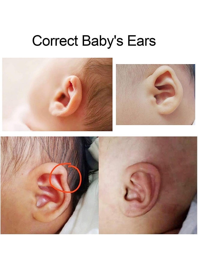 JS Infant Silicone Auricle Correction Patch, Aesthetic Corrector for Babies Newborn Kids with Protruding Ears - Image 2
