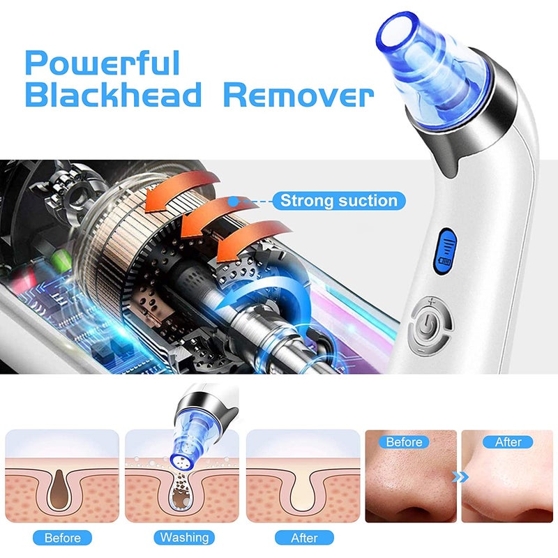 Blackhead Remover Vacuum, Pore Suction Facial Skin Vacuum Tool Blackhead Vacuum Valentines Day Gifts for Her Women Him Men (Blue) - Image 4