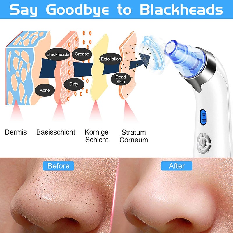 Blackhead Remover Vacuum, Pore Suction Facial Skin Vacuum Tool Blackhead Vacuum Valentines Day Gifts for Her Women Him Men (Blue) - Image 3