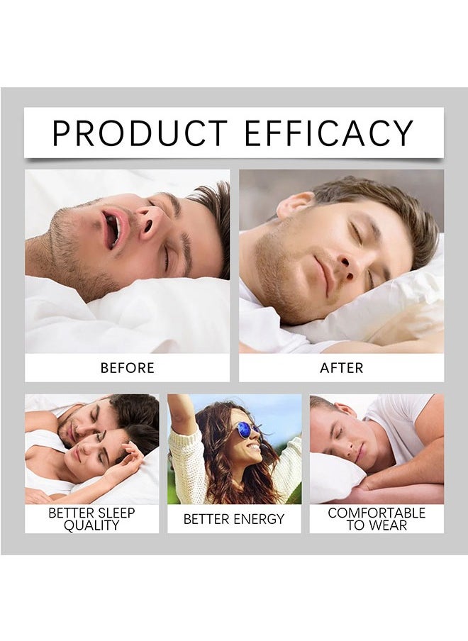Anti-Snoring Braces,Water Decoction At Night To Prevent Snoring,Mlolar support To Prevent Snoring And Protect Braces.