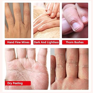 HUALIJIA 3 Pairs Hands Mask Moisturizing Gloves Hand Skin Repair Renew Mask Infused Collagen Vitamins Natural Plant Extracts for Dry Aging Cracked Hands - Image 3