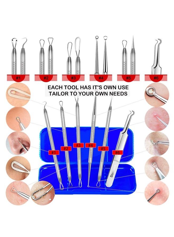 Cbiumpro Blackhead Remover Tools, Blackhead Extractor, 6 Pack Pimple Popper Tool Kit for Removing Blackhead, Whitehead, Pimple, Acne, Zit, Comdone, Pores, Fat Granules on Nose, Face - with Organized Case - Image 4