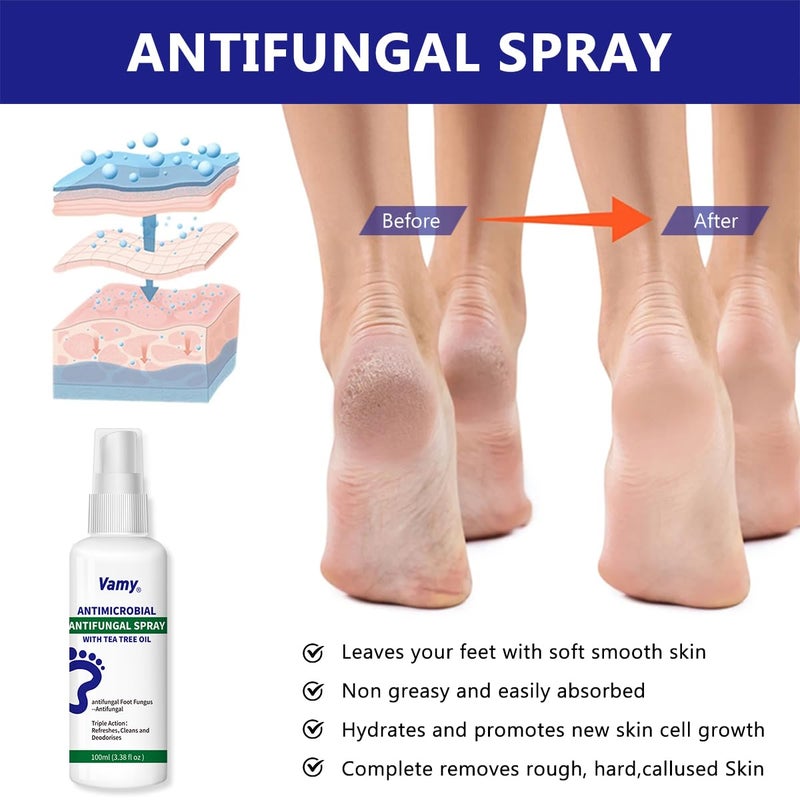 Vamy Complete Foot & Nail Kit Nail Solution And Foot Sanitizer Spray With Tea Tree Oil 3.38Oz (1 Ct) - Image 4