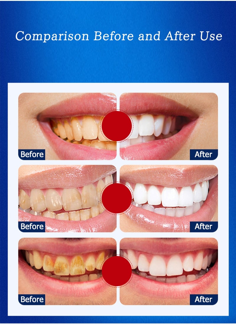 Generic - 5D White Teeth Whitening Strips Advanced Fast Effective 3 Days Significant Whitening Portable Comfortable Easy to Use 7Pcs/Pack - Image 1