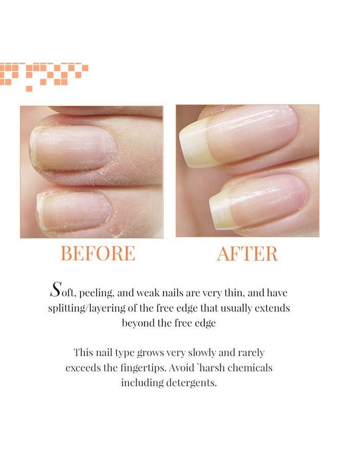 Nail Tek Foundation 2 Ridge Filling Strengthening Base Coat For Soft And Peeling Nails 0.5 Oz 1Pack  - Image 5