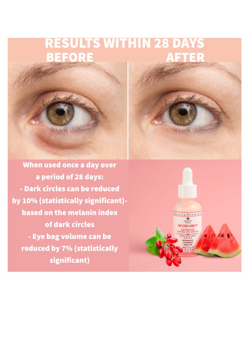 Nature Spell - Serum to Reduce Dark Circles and Puffiness Around the Eyes with Watermelon and Berries 30 ML - Image 1