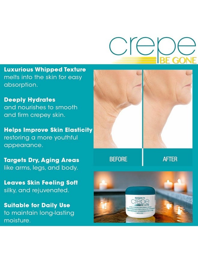 ديرماكتين سوفليه الجسم ديرماكتين كريب بي غون 2.5 أونصة (عبوة من 6 قطع) - Image 4