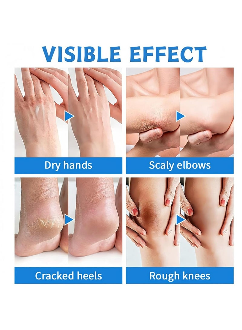 LANEMAY 2PCS Multiple Effects Foot Cream Set – 60% Urea Foot Cream & Peach Scent Heel Balm Stick – Exfoliating & Moisturizing Foot Care Duo for Dry Cracked Heels & Feet, 1.41oz Each - Image 5