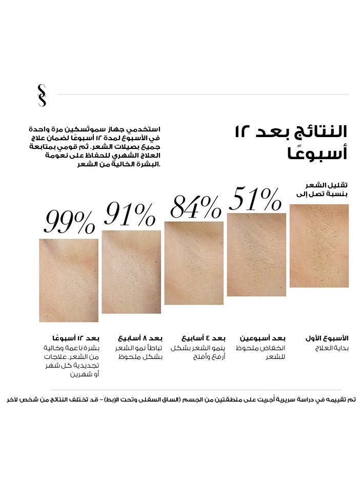 SMOOTHSKIN New Pure Fit Ultrafast Painless IPL Permanent laser hair removal home device and machine for Women & Men - Body & Face,hair removal system,Clinically Tested and FDA Cleared. - pzsku/Z36AA2F588FADFCAE554BZ/45/_/1740904637/981fd736-3450-4af6-ae88-b28288721f38