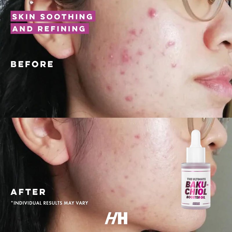 Handmade Heroes 2% Bakuchiol Oil Lifting and Firming Oil for Guasha Neck, and DÃ©colletÃ©, All Natural Retinol Alternative For Radiant and Line Smoothing 0.75oz - Image 2