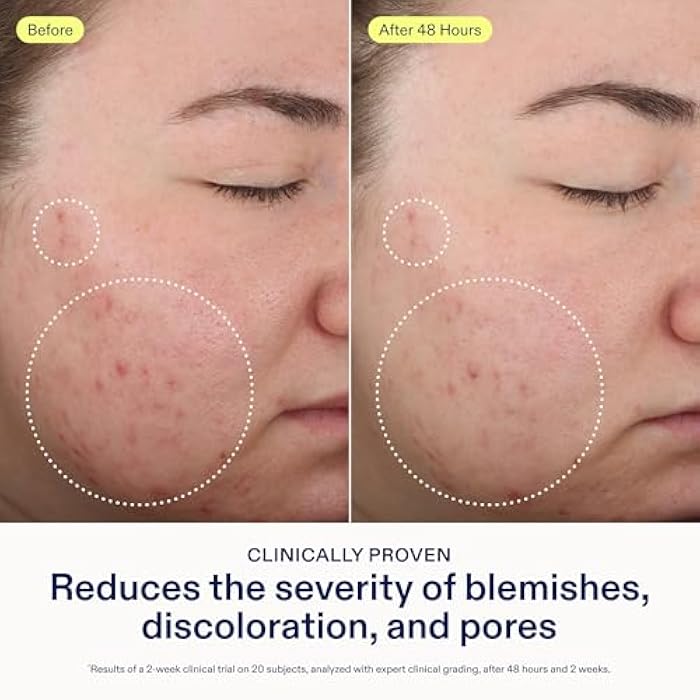 Skinfix 2% BHA Cleanser - 5 oz - Clears Acne Blemishes & Blackheads - Safe for All Types of Acne - Fragrance Free - Vegan, Cruelty Free - Image 3