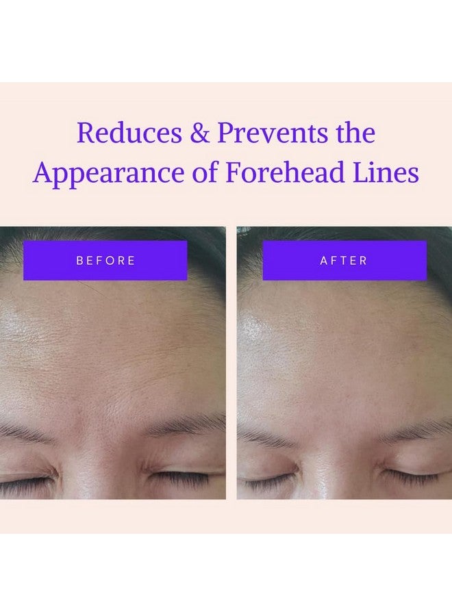 BLUMBODY Blumbody Forehead Wrinkle Patches - Anti Wrinkle Facial Patches to Smooth Eyes & Forehead Wrinkles - Non-Silicone Face Tape for Fine Wrinkles between Eyes & Face - 50 Patches (Up to 60 day supply) - Image 2