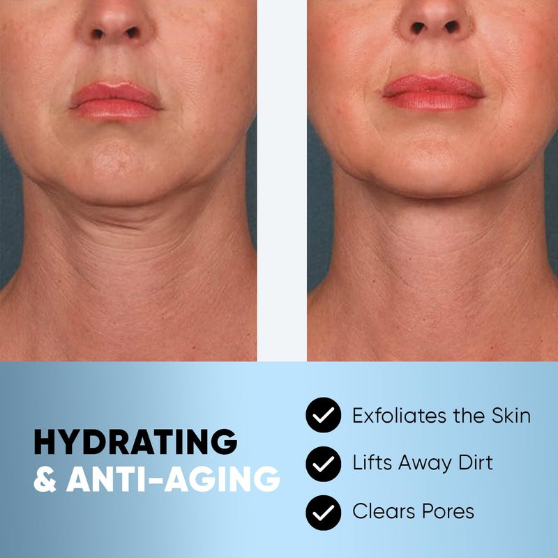 ESTETIST V Line Lifting Mask, V Shaped Slimming Face & Neck Tightening Patch for Double Chin, Firming & Lifting Face Belt for Jawline and Chin, No Wrinkle Mask, 5 Pack - Image 5