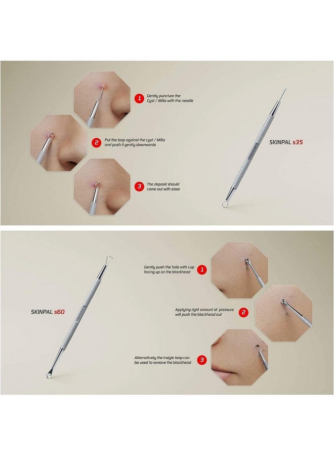 Suvorna Skinpal Pimple Popper Tool Kit Milia Remover Lancets For Facial Extraction Whitehead Extractor Tool Comedone Extractor Blackhead Remover Tool Acne Needle Tool & Cyst Removal Tool. - Image 3
