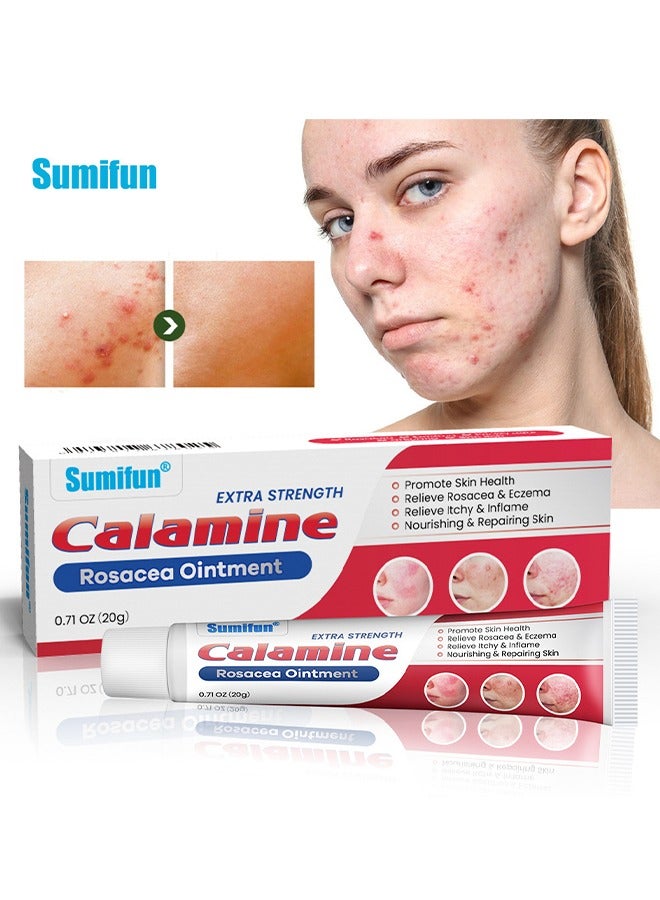 سوميفون مرهم الكالامين الوردية ، مرهم شفاء مغذي لإصلاح قوة إضافية ، تخفيف فعال للوردية والأكزيما ، تخفيف سريع للحكة والالتهاب ، تعزيز صحة الجلد 20 جرام - Image 1