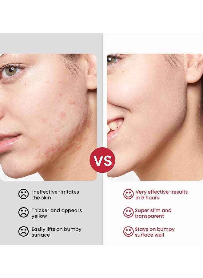 سوميفون مرهم الكالامين الوردية ، مرهم شفاء مغذي لإصلاح قوة إضافية ، تخفيف فعال للوردية والأكزيما ، تخفيف سريع للحكة والالتهاب ، تعزيز صحة الجلد 20 جرام - Image 2