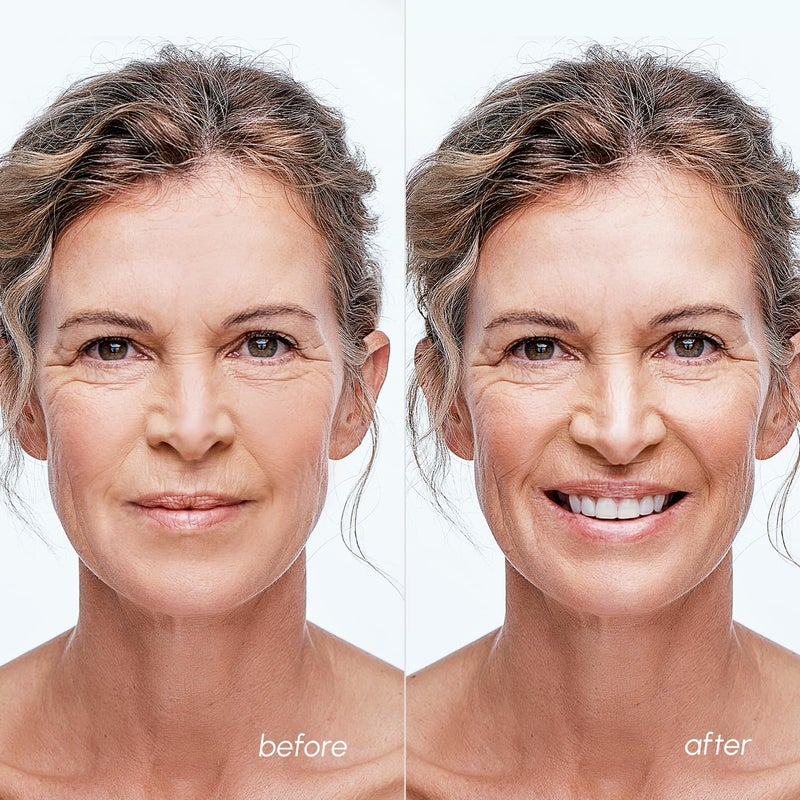 MAREE Blemish Acne Clearing Polishes - Daily Facial Radiance Toner Pads - Witch Hazel Pads Acne Face Toning - Acne Skin Care with BHA Salicylic Acid - Blemish Clearing Witch Hazel Device - Image 5