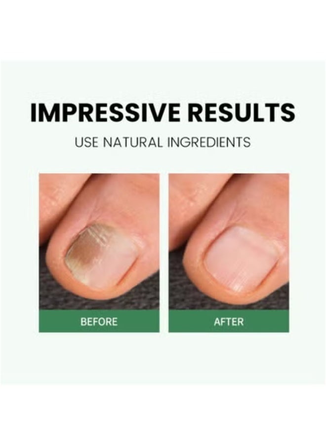 نيل 2-pack Nail Art Rotating Edge Pen Nutrition Oil Moisturizing Anti-Dead Skin Barb Nail Oil 5g*2 - Image 3