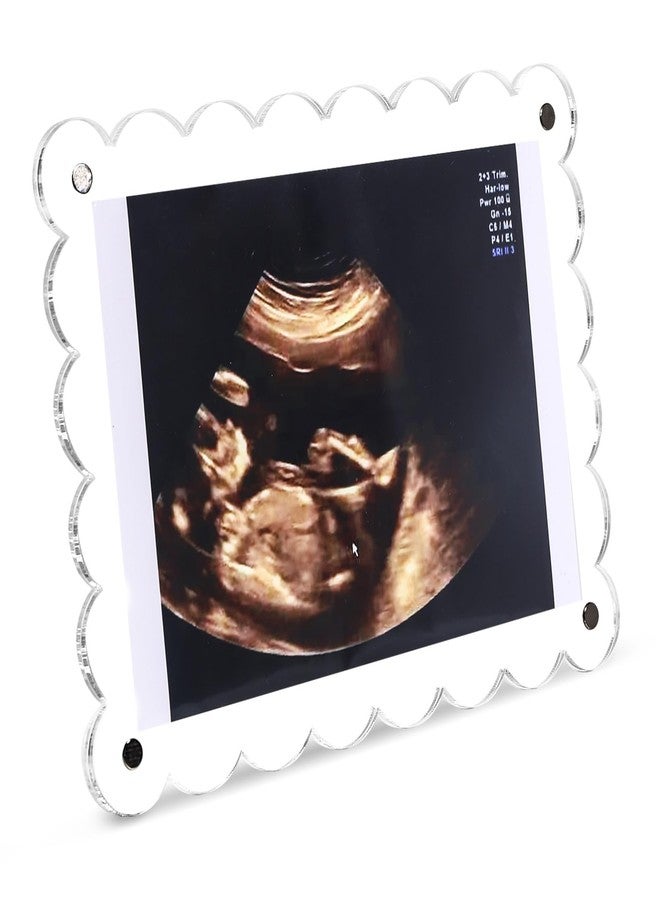 Mlatnod Magnetic Clear Acrylic Scalloped Baby Ultrasound Picture Frame - Sonogram Frame for Refrigerator, Display for Pregnancy Announcement, Gender Reveal & Expecting Parents Gifts(No Stand) - Image 1