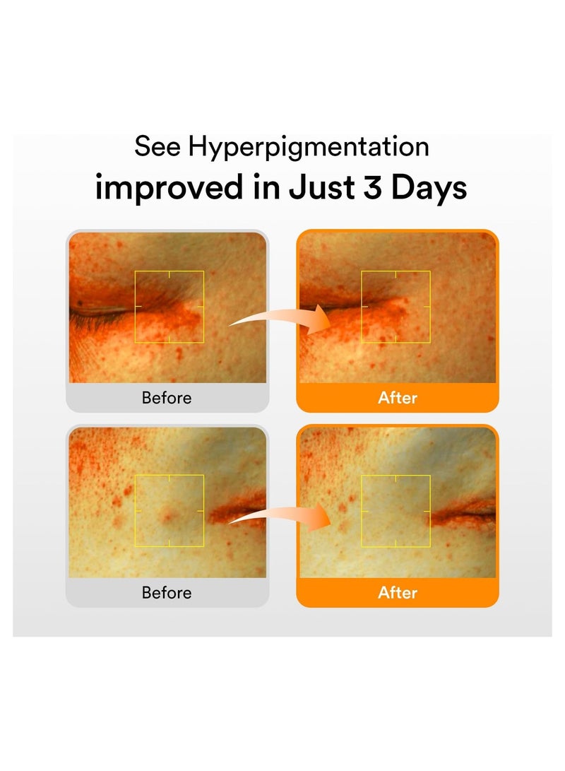 ابيب سيروم فيتا دروب للبقع الداكنة بالجلوتاثيوسوم، 1.69 أونصة سائلة | منتجات العناية بالبشرة الكورية، علاج البقع الداكنة وفرط التصبغ | سيروم مُفتّح للبشرة الحساسة وغير المُوحدة | نياسيناميد، فيتامين سي - Image 3