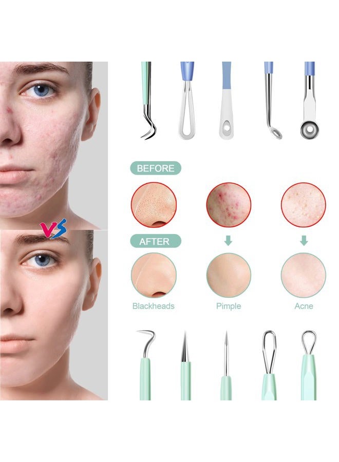 MENOLY Latest 10 Pcs Blackhead Remover Pimple Popper Tool Kit, Acne Kit for Blackhead, Zit Removing, Whitehead Popping and Comedone Extractor Tool, with a Leather Bag (Blue) - Image 3