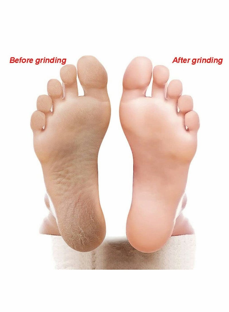 SYOSI 4 Pcs Double-Sided Foot File, Callus Remover Dead Skin and Double-Sided Foot Scrubber Foot Files Kit Heel Scraper Foot Scrub Care Tool to Remove Rough Cracked Corns Smoothing Hard Skin  - Image 4