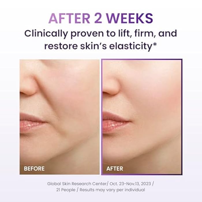 BIOHEAL BOH كريم BIOHEAL BOH Probioderm لرفع الوجه 3D 1.7 أونصة سائلة | كريم ليلي مرطب متقدم مضاد للشيخوخة بالبروبيوتيك الكوري مع مركب 17-ببتيد وProbioderm الحاصل على براءة اختراع للتجاعيد على الوجه والرقبة - Image 4