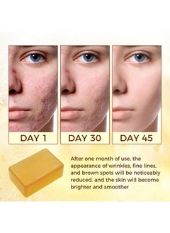 OUKEYA OUKEYA Dark Spot Remover Soap Bars, Turmeric Soap Bar, for Body & Face with Vitamin C, E, Retinol, Collagen, Shea Butter, Infused with Hyaluronic Acid, 2 Pack, Natural Soap for Men, Women  - Image 3