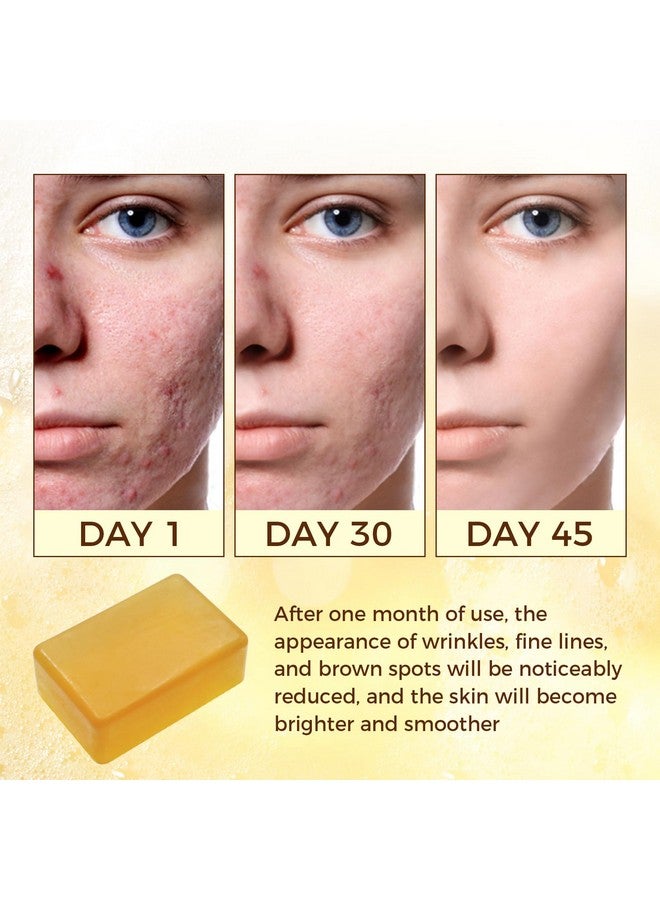 OUKEYA Dark Spot Remover Soap Bars, Turmeric Soap Bar, for Body & Face with Vitamin C, E, Retinol, Collagen, Shea Butter, Infused with Hyaluronic Acid, 2 Pack, Natural Soap for Men, Women - Image 3