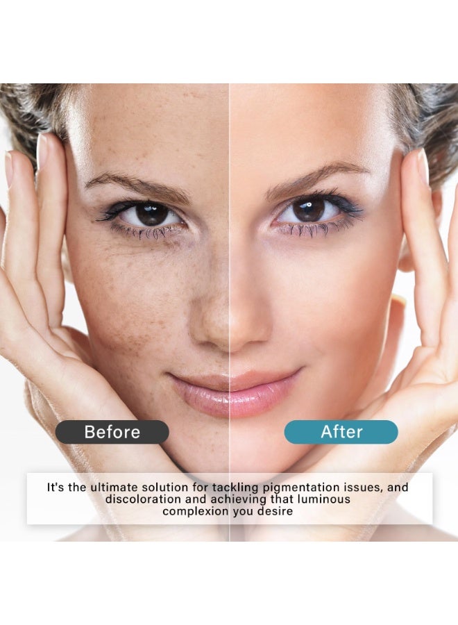لومينوس سيروم ترانيكساميك أسيد المضيء مع النياسيناميد وحمض الكوجيك – مصحح البقع الداكنة وعلاج فرط التصبغ – سيروم تبييض وتوحيد لون البشرة – تركيبة مرطبة ومغذية بحمض الهيالورونيك – 30 مل - Image 3