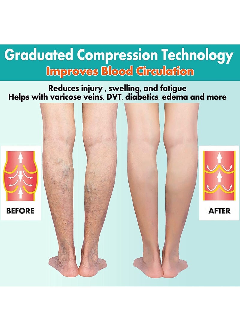 Generic 2 Pairs Compression Socks Open Toe Compression Stockings Knee High Socks with Zipper Compression Pantyhose 15-20mmHg for Improves Blood Circulation Prevents Leg Swelling (Beige Black)  - Image 3