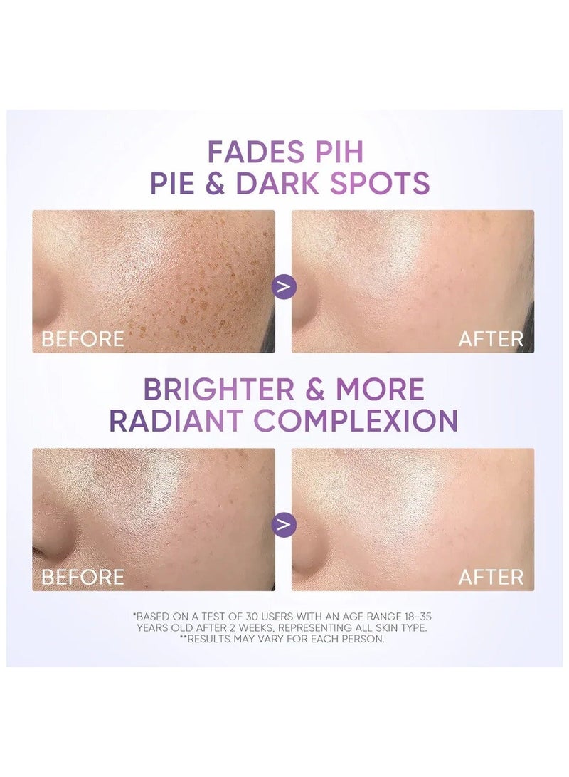 سكينتفيك سيموايت 377 مرطب للبقع الداكنة 30 جرام - Image 3