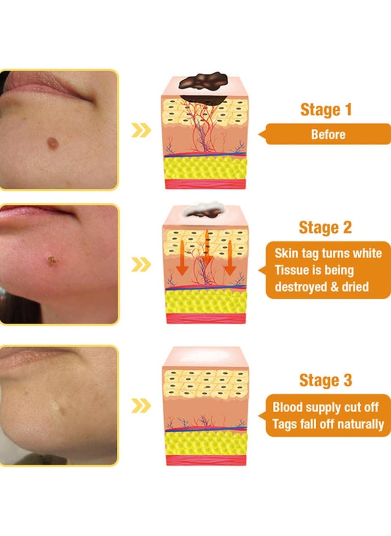 Houkea Bee Venom Moles and Wart Removal Cream Mole and Wart Cream Easy Application and No Irritation Wart and Tag Remover Bee Venom Repair Cream Wart Treatment Cream  - Image 3