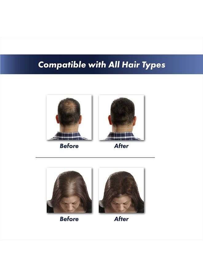 KeraFiber Hair Building Fibres - Natural Keratin Hair thickener Fibres, Hair Powder for Men and Women, Full Head of Hair in 30 Seconds-Hair Fibres Black - Image 2