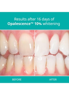 Opalescence Opalescence PF Doctor Kit 10%, Mint  - Image 2