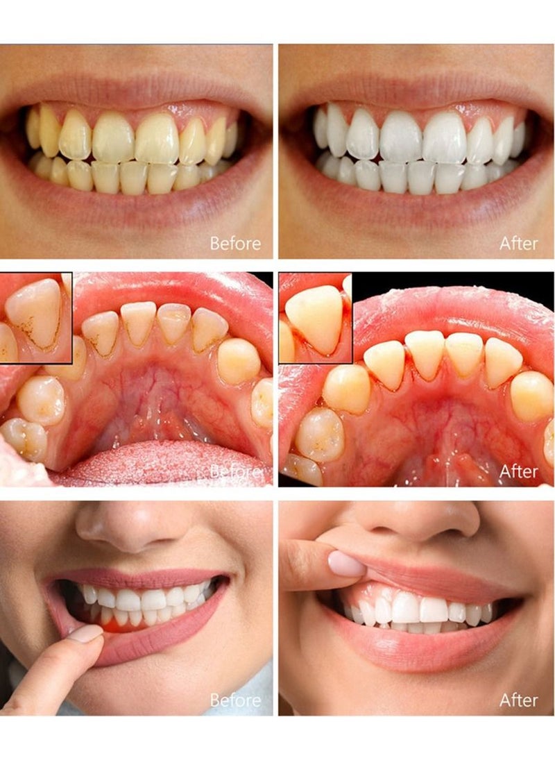 إيلهو مصحح أرجواني 50 مل، معجون أسنان لتبييض الأسنان، تنظيف الأسنان الصفراء، مصحح اللون وإزالة البقع بشكل فعال، العناية بصحة الفم - Image 4