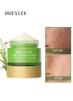 Breylee Acne Treatment Ceam Acne Removal Acne Pimple Repair Cream, Acne Spot Treatment for Face & Acne Dots, Natural Cystic Acne Treatment, For All Skin Types, 20g  - Image 1