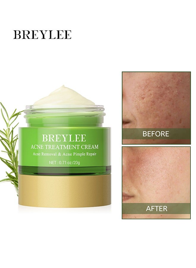 Breylee Acne Treatment Ceam Acne Removal Acne Pimple Repair Cream, Acne Spot Treatment for Face & Acne Dots, Natural Cystic Acne Treatment, For All Skin Types, 20g - Image 1