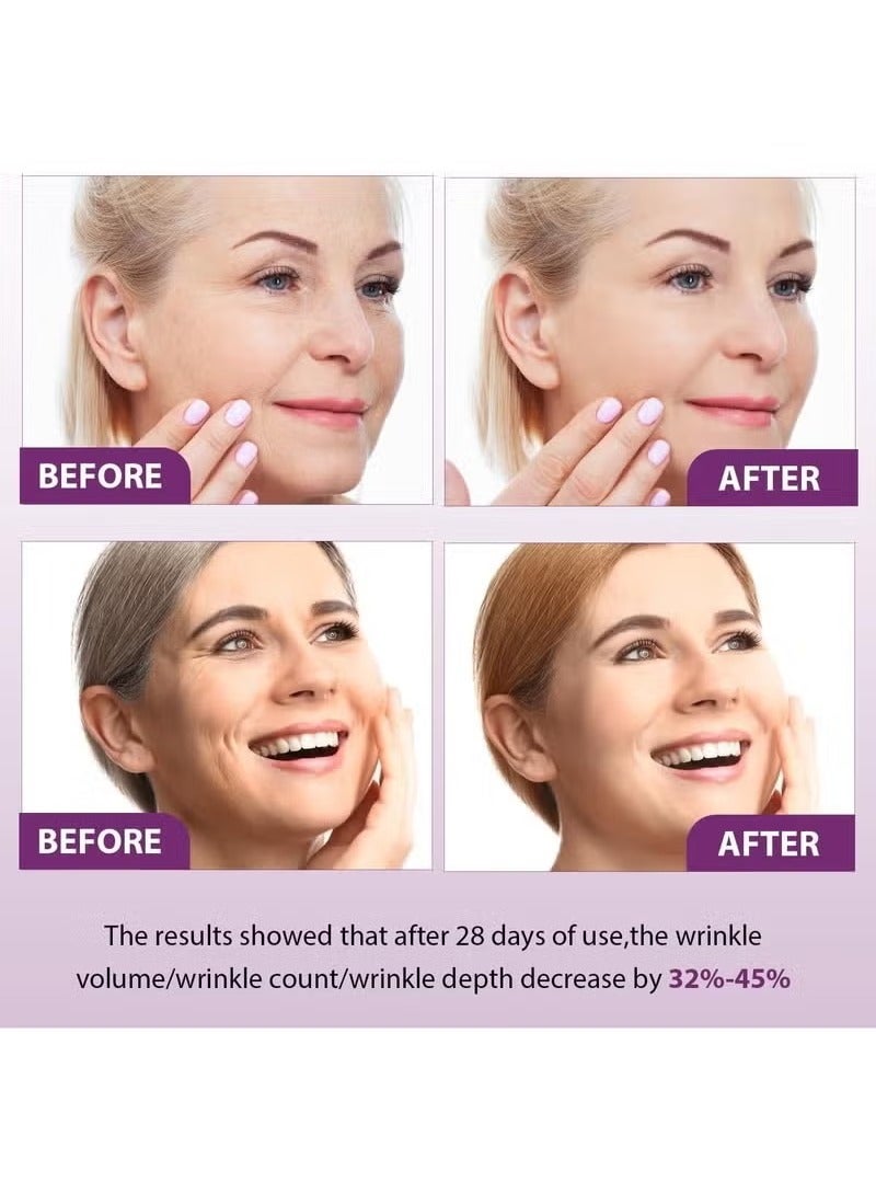 فانستا Bakuchiol الريتينول الجوهر ، المضادة للتجاعيد اشراق الجلد تجديد الريتينول الجوهر ، جوهر الوجه للرجال والنساء الريتينول - Image 5