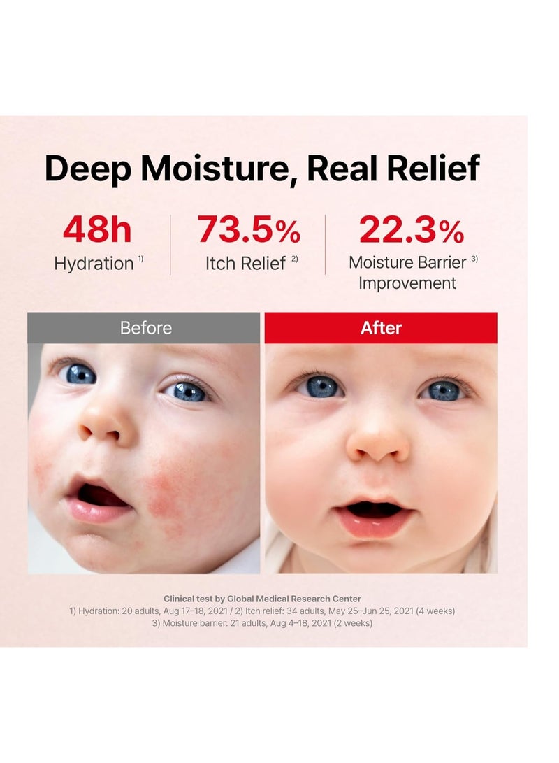 أتوبالم كريم أتو بالمر للترطيب المكثف 100 مل - Image 4