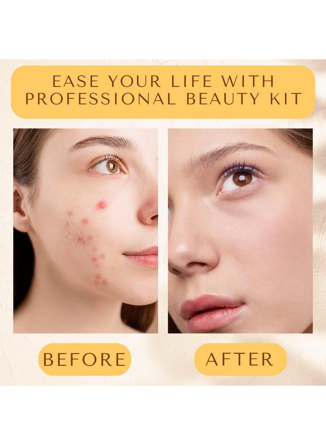 DERMATED [16 Pcs] Blackhead Remover Tools 2025 Latest Pimple Popper Tool Kit | Stainless Steel Professional Pimple Extractor Tool Kit for Blackheads, Blemish, Comdone, Acne, Zit, and Whiteheads for Face & Nose - Image 5