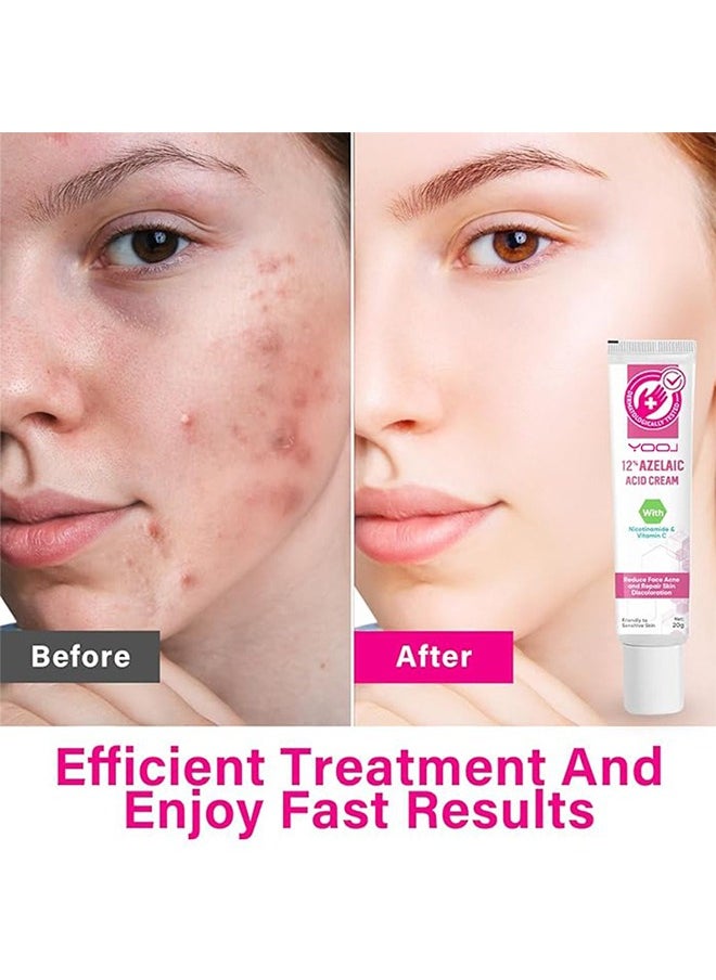 CARVENCHY - 12% Azelaic Acid Serum, Hyaluronic Acid,Niacinamide and Vitamin C for Redness Relief Face, Dark Spot, Rosacea Acne, Balance Excess Sebum,Brightening Face Skin Care Treatment 20g - Image 1