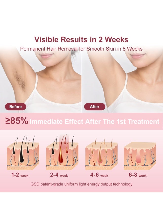 DEESS GP591 3IN1 Unlimited Flashes Laser Hair Removal, IPL Permanent Hair Removal Device with Ice Cooling Function, Home Laser Hair Remover For Women & Men, Painless, Long-lasting Reduction Results For Armpits Leg Arm Back Whole Body, 3 Replaceable Lamps(HR+AC+SR) pink - Image 3