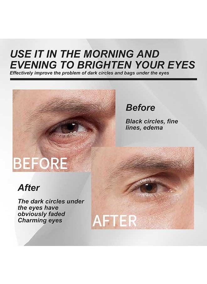 EELHOE Men's Eye Cream 7ml，Fight Against Wrinkles And Signs Of Aging Around The Eyes, Boosts Hydration，Reduces Puffiness，Lightens Dark Circles, Suitable For All Skin Types  - Image 5