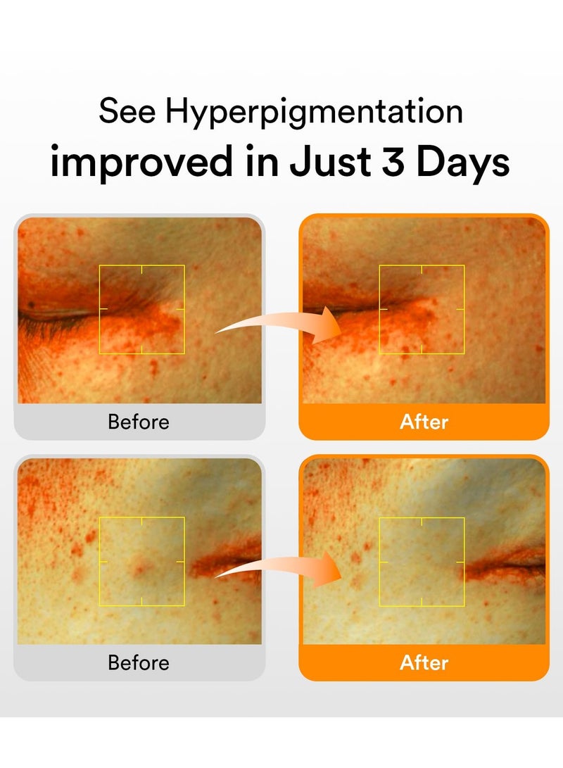 ابيب أبيْب غلوتاثيوسوم سيروم لتفتيح البقع الداكنة فيتا دروب 50 مل - Image 3