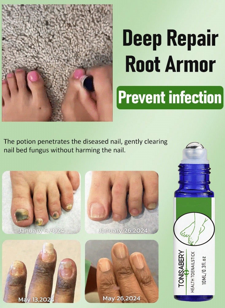 TONISABERY علاج صحة الأظافر التالفة - لفة إصلاح الأظافر المتشققة - زيت كوتيكل طبيعي مهدئ وملين - 10 مل - Image 5
