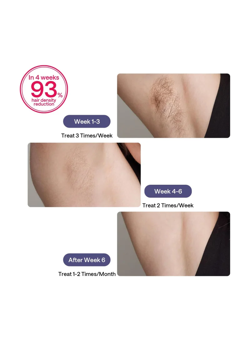 Ulike  Laser Hair Removal device for Women and Men, Air 3 Ice-Cooling IPL Device Hair Removal for Nearly Painless & Long-Lasting Results, 3 Modes & Auto Flashing for Fast Full Body Hair Removal from Home, with leather case, Purple  | Best Price UAE